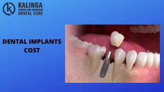 DENTAL IMPLANTS COST