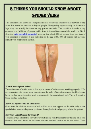 5 Things you should know about spider veins