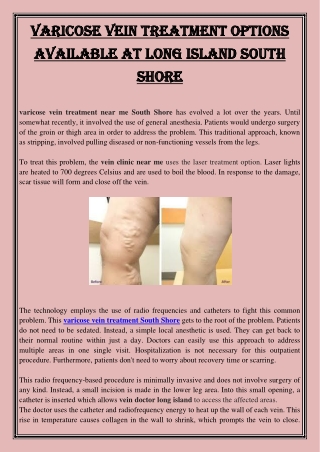Varicose vein treatment options available at Long island south shore