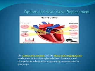 Options for Heart Valve Replacement