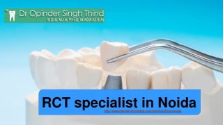 Root Canal specialist in Noida