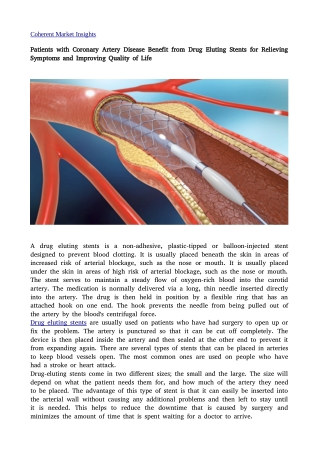 Drug Eluting Stents12