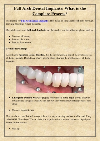 Full Arch Dental Implants What is the Complete Process