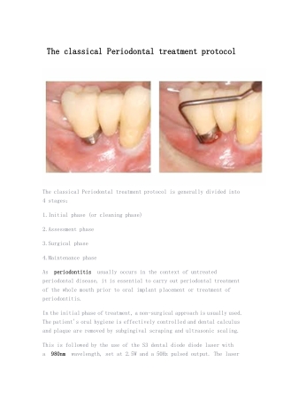 The classical Periodontal treatment protocol