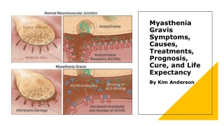 Myasthenia gravis 4