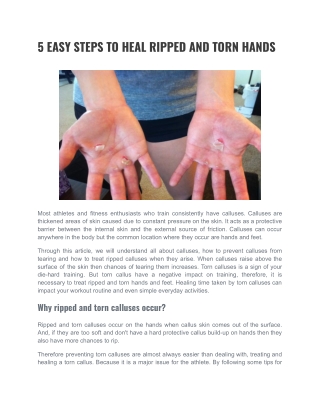 5 EASY STEPS TO HEAL RIPPED AND TORN HANDS