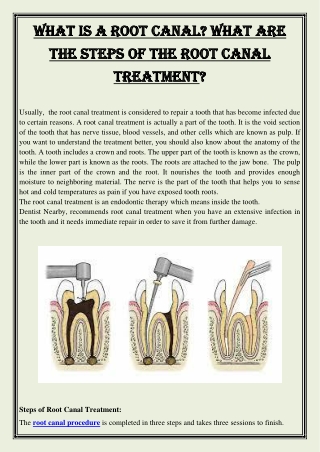 What is a root canal What are the steps of the root canal treatment