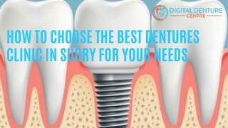 How To Choose The Best Dentures Clinic In Surry For Your Needs