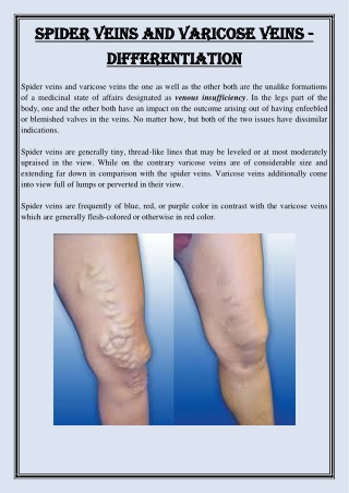 Spider Veins and Varicose Veins - Differentiation