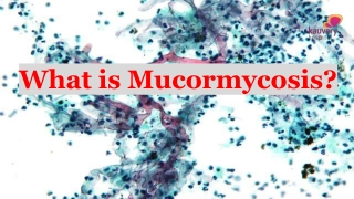 What is Mucormycosis?