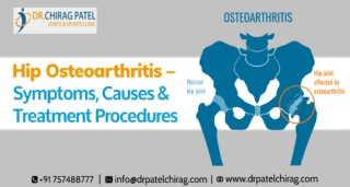 Hip Osteoarthritis – Symptoms, Causes & Treatment Procedures | Dr Chirag Patel