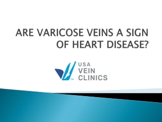ARE VARICOSE VEINS A SIGN OF HEART DISEASE