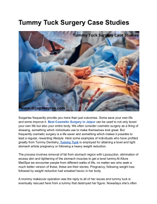 Tummy Tuck Surgery Case Studies