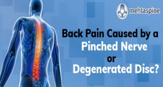 Back Pain Caused by a Pinched Nerve or Degenerated Disc? - Mehta Spine