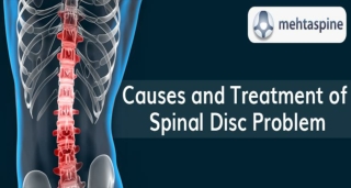 Causes and Treatment of Spinal Disc Problem - Mehta Spine