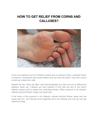 HOW TO GET RELIEF FROM CORNS AND CALLUSES