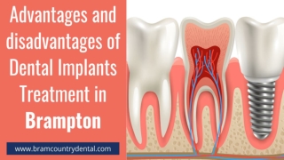 Advantages and disadvantages of Dental Implants Treatment in Brampton