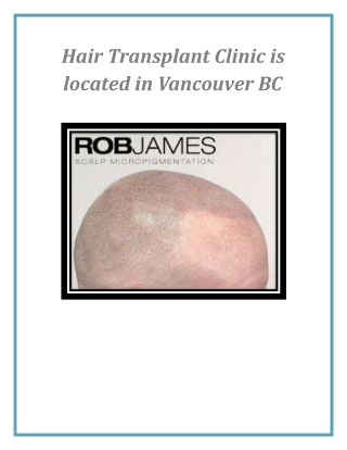 Hair Transplant Clinic is located in Vancouver BC