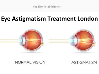 Eye Astigmatism Treatment London