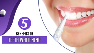 5 Benefits of Teeth Whitening