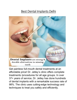 Best Dental Implants Delhi