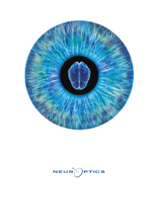 Introducing the NeurOptics Smart Approach to Pupillary Evaluation