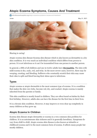 skindiseasehospital.org-Atopic Eczema Symptoms Causes And Treatment
