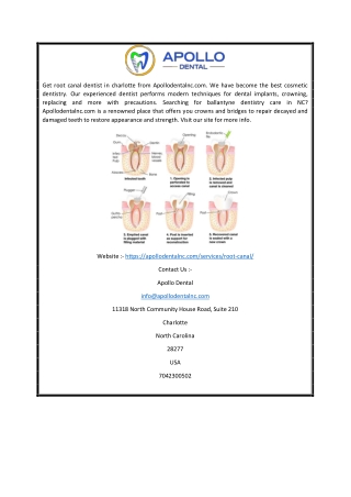 Root Canal Dentist Charlotte  Apollodentalnc.com