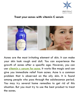 Treat your acnes with vitamin C serum