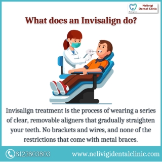 What does an Invisalign do - Best Dental Clinic in Bellandur - Nelivigi Dental