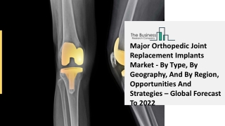 Global Major Orthopedic Joint Replacement Implants Market Overview