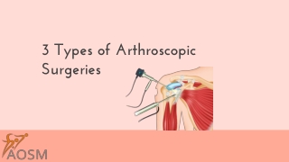 3 Types of Arthroscopic Surgeries