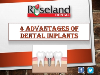 4 Advantages of Dental Implants