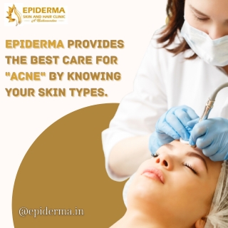 Acne Treatment - Best Dermatology Centres in Jayanagar, Bangalore - Epiderma Clinic