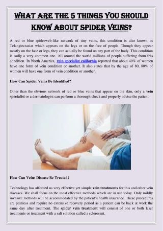 What are the 5 things you should know about spider veins