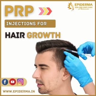 PRP Injections | Best Dermatology Centres in Jayanagar | Epiderma Clinic