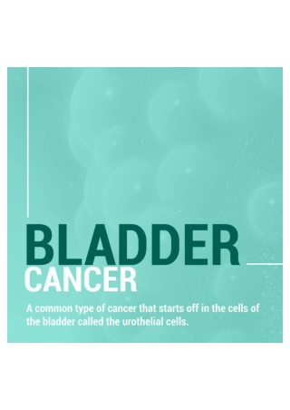 Bladder Cancer: The Complete Guide!