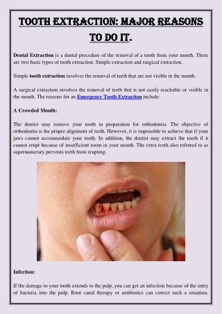 Tooth Extraction  Major Reasons To Do It