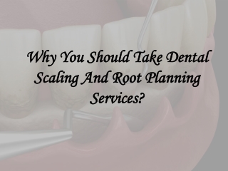 Why You Should Take Dental Scaling And Root Planning Services
