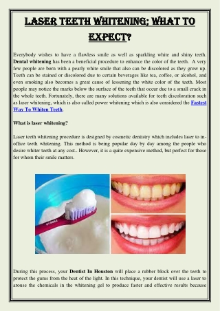 Laser Teeth Whitening; What To expect