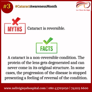 Myth #3 about Cataract - Best Eye Hospitals in Bellandur - Nelivigi Eye Hospital