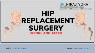 Hip Replacement Surgery Before and After
