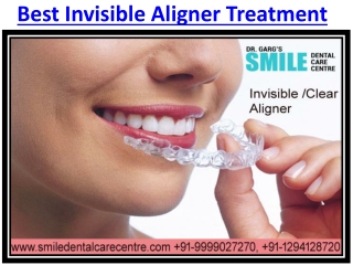 Need Best Invisible Aligner Treatment in Faridabad Then Visit Smile Dental