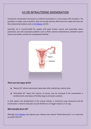 What is IUI or Intrauterine Insemination?