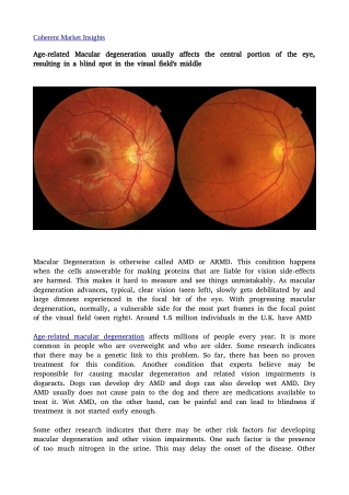 Age-related Macular degeneration17j