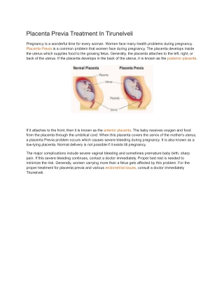 Placenta Previa Treatment In Tirunelveli