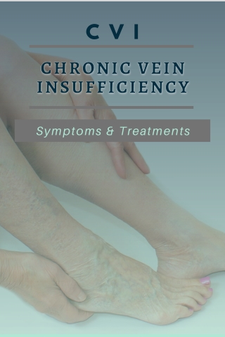 Chronic Vein Insufficiency It's Symptoms & Treatments