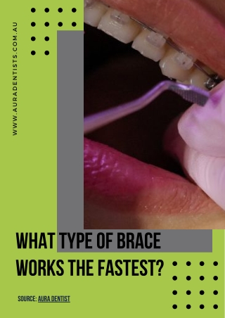 How Fast Dental Braces Treatment Work?