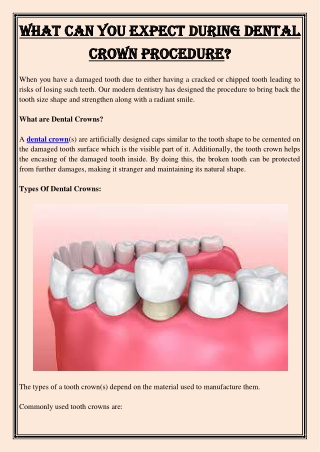 What Can You Expect During Dental Crown Procedure