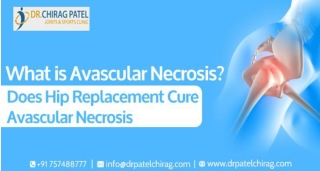 Causes and Risk Factors for Avascular Necrosis | Best Joint Replacement Surgeon